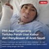 PMI Asal Tangerang Terluka Parah Usai Kabur dari Penyiksaan di Arab Saudi