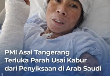 PMI Asal Tangerang Terluka Parah Usai Kabur dari Penyiksaan di Arab Saudi