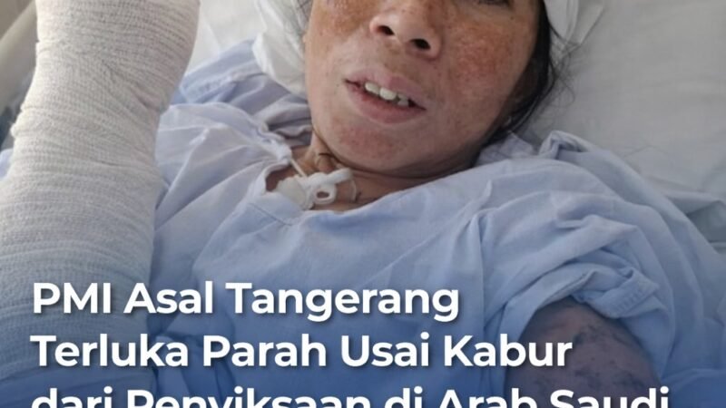 PMI Asal Tangerang Terluka Parah Usai Kabur dari Penyiksaan di Arab Saudi